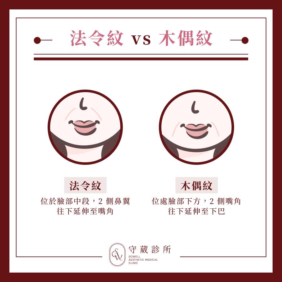 法令紋 vs 木偶紋