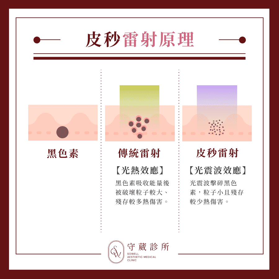 皮秒雷射原理