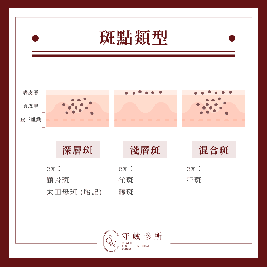 斑點類型