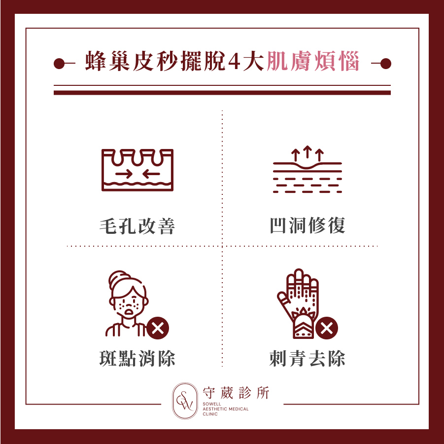 蜂巢皮秒擺脫 4 大肌膚煩惱